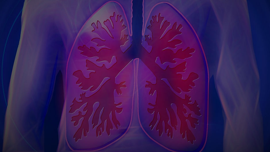 pleural or ascitic fluid in lungs