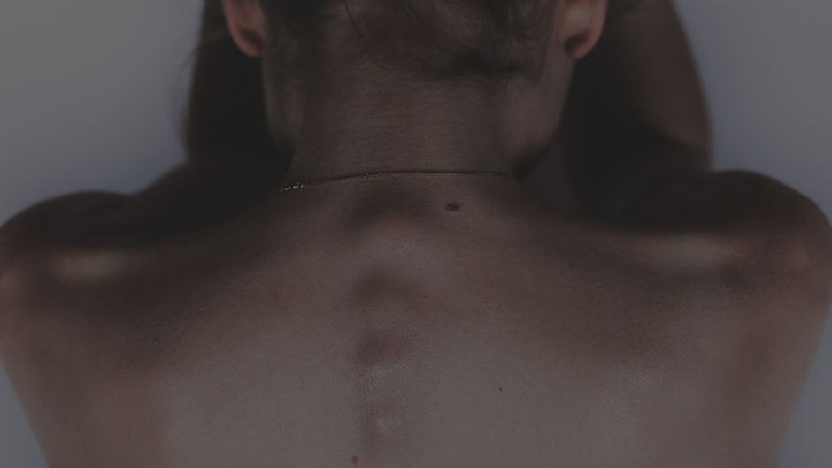 view of upper spine on human to demonstrate cerebrospinal fluid test