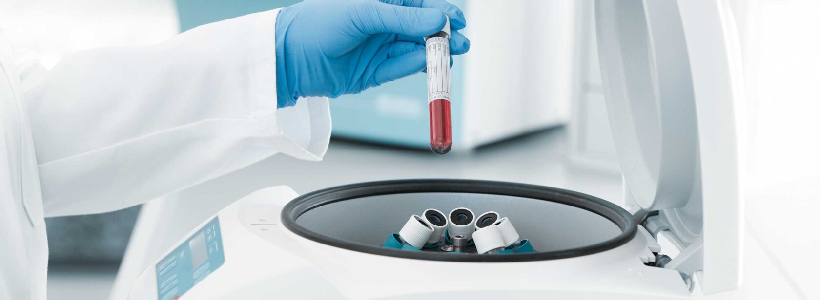 Hettich EBA series small centrifuge